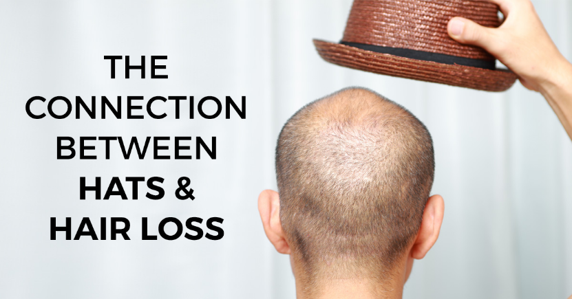 can hats cause hair loss